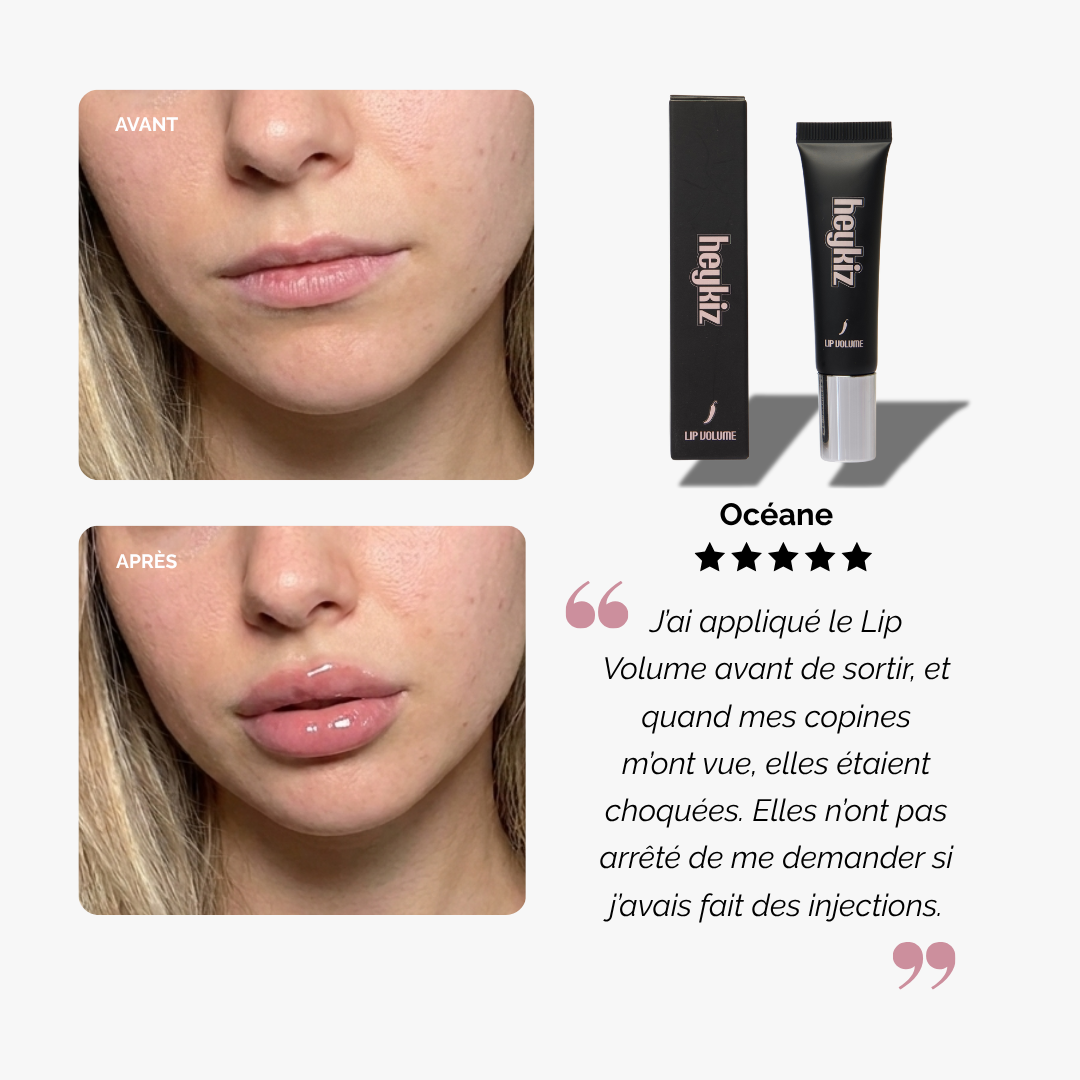 Lip Volume (Offre limitée)
