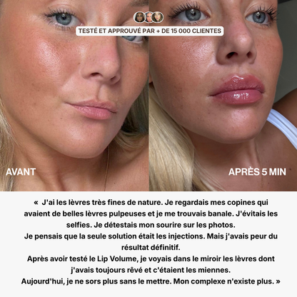 Lip Volume (Offre limitée)