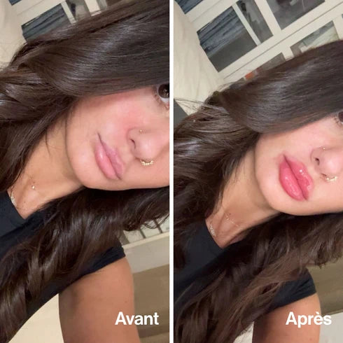 Lip Volume (Offre limitée)