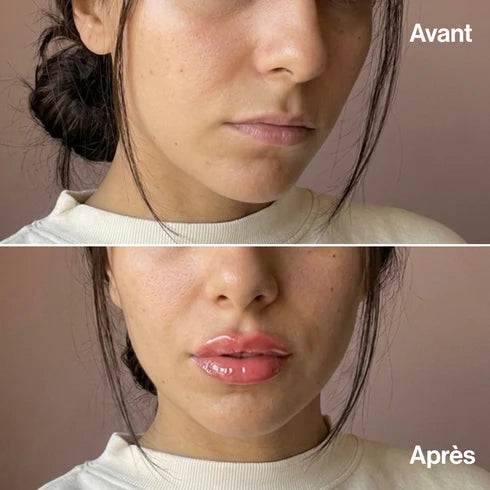 Lip Volume Extrême